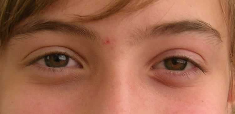 Superior Scleral Cover Shells - Eyes Alive